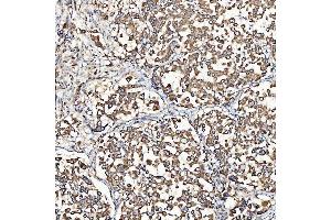 IHC analysis of SH2D4A using anti-SH2D4A antibody (ABIN7601695). (SH2D4A anticorps  (AA 42-454))