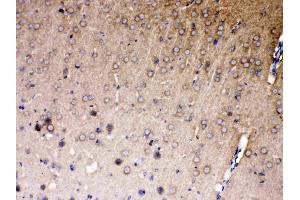 IHC analysis of NDRG3 using anti- NDRG3 antibody .
