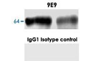 Western blot analysis in normal mouse brain with GPC1 monoclonal antibody, clone 9E9 . (GPC1 anticorps)