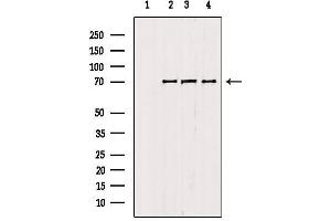 Western blot analysis of extracts from various samples, using RNF156 antibody. (Mahogunin RING Finger Protein 1 anticorps  (Internal Region))