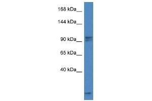 Western Blot showing Aak1 antibody used at a concentration of 1. (AAK1 anticorps  (C-Term))