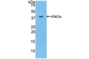 Detection of Recombinant NFkB, Mouse using Polyclonal Antibody to Nuclear Factor Kappa B (NFkB)