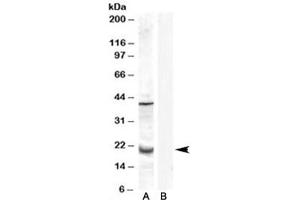Western blot testing of human prostate lysate with GPX7 antibody at 0. (Glutathione Peroxidase 7 anticorps)