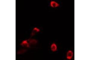 ABIN6274125 staining HT29 cells by IF/ICC. (TAF5L anticorps  (Internal Region))