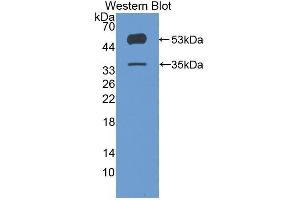 Western Blotting (WB) image for anti-Angiopoietin-Like 4 (ANGPTL4) (AA 182-388) antibody (ABIN1858007) (ANGPTL4 anticorps  (AA 182-388))