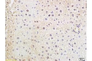 Formalin-fixed and paraffin embedded mouse liver labeled with Anti-DNTT Polyclonal Antibody, Unconjugated (ABIN681973) at 1:200 followed by conjugation to the secondary antibody and DAB staining (TdT anticorps  (AA 351-450))