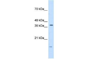 WB Suggested Anti-TFB2M Antibody Titration:  5. (TFB2M anticorps  (C-Term))