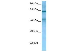 WB Suggested Anti-TIMD4 Antibody Titration: 1. (TIMD4 anticorps  (N-Term))