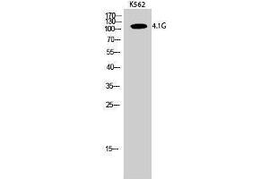 Western Blotting (WB) image for anti-erythrocyte Membrane Protein Band 4.1-Like 2 (EPB41L2) (Internal Region) antibody (ABIN3183088) (EPB41L2 anticorps  (Internal Region))