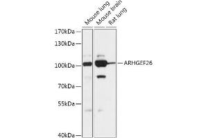 Western blot analysis of extracts of various cell lines, using  antibody (ABIN7269968) at 1:1000 dilution. (SGEF anticorps  (AA 592-871))