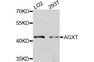 Western blot analysis of extracts of LO2 and 293T cells, using AGXT antibody. (AGXT anticorps)
