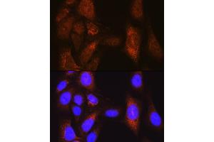 Immunofluorescence analysis of U-2 OS cells using PLK1 Rabbit pAb (ABIN3023351, ABIN3023352, ABIN3023353 and ABIN6219645) at dilution of 1:100 (40x lens). (PLK1 anticorps  (AA 304-603))