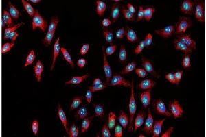 IF analysis of Nucleostemin/GNL3 using anti-Nucleostemin/GNL3 antibody (ABIN7601778).