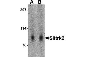 Western Blotting (WB) image for anti-SLIT and NTRK-Like Family, Member 2 (SLITRK2) (Middle Region) antibody (ABIN1031099)