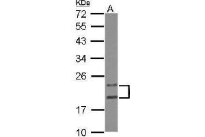 WB Image Sample (30 ug of whole cell lysate) A: HeLa 12% SDS PAGE antibody diluted at 1:1000 (PYCARD anticorps)