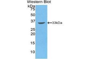 Western Blotting (WB) image for anti-Proto-Oncogene Pim-2 (Serine Threonine Kinase) (PIM2) (AA 34-292) antibody (ABIN1860223) (PIM2 anticorps  (AA 34-292))