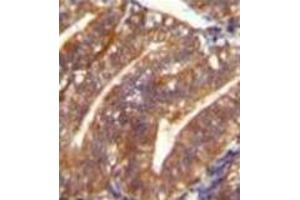 Formalin fixed and paraffin embedded human uterus tissue reacted with Periostin Antibody (C-term) followed by peroxidase conjugation of the secondary antibody and DAB staining.