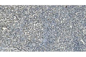 IHC analysis of LSM8 using anti-LSM8 antibody (ABIN7599579). (NAA38 anticorps  (AA 1-96))