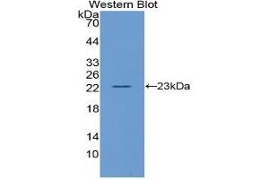 WB of Protein Standard: different control antibodies against Highly purified E.