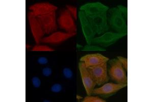 ABIN6262388 and ABIN6266563 staining Hela cells by IF/ICC.