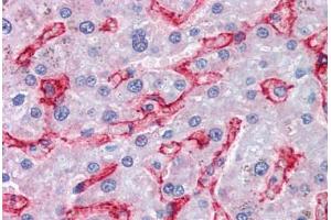 Human Liver (formalin-fixed, paraffin-embedded) stained with AOC3 antibody ABIN351485 at 3. (AOC3 anticorps  (AA 712-724))