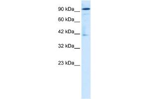 WB Suggested Anti-ZA20D1 Antibody Titration:  1. (OTUD7B anticorps  (Middle Region))