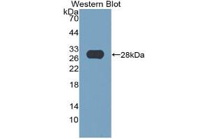 Western blot analysis of the recombinant protein. (Thyroperoxidase anticorps  (AA 636-832))