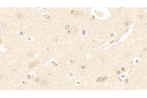 Detection of SAT1 in Human Cerebrum Tissue using Polyclonal Antibody to Spermidine/Spermine N1-Acetyltransferase 1 (SAT1) (SAT1 anticorps  (AA 1-171))