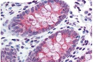 Colon, Human: Formalin-Fixed, Paraffin-Embedded (FFPE) (TMPRSS4 anticorps  (Internal Region))