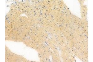 ABIN6258312 and ABIN6273385 at 1/100 staining human normal colon tissue by IHC-P. (RFPL1 anticorps  (Internal Region))