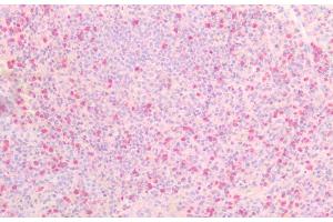 Detection of TNFRSF21 in Human Spleen Tissue using Polyclonal Antibody to Tumor Necrosis Factor Receptor Superfamily, Member 21 (TNFRSF21)