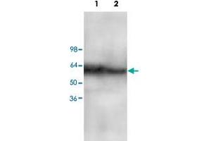 Western blot analysis of Jurkat (Lane 1) and MCF-7 (Lane 2) cell lysate with CARD10 polyclonal antibody  at 1 : 200 dilution. (CARD10 anticorps  (C-Term))