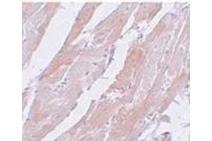 Immunohistochemistry of CCDC47 in mouse heart tissue with CCDC47 antibody at 5 μg/ml.
