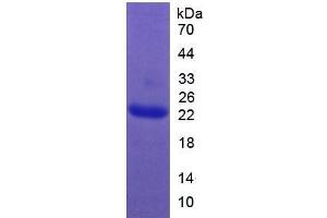 SDS-PAGE of Protein Standard from the Kit (Highly purified E. (Growth Hormone 1 Kit CLIA)