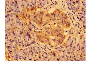 Immunohistochemistry of paraffin-embedded human pancreatic tissue using ABIN7166602 at dilution of 1:100 (PSORS1C1 anticorps  (AA 1-152))