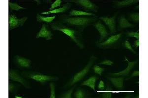 Immunofluorescence of monoclonal antibody to CYP26B1 on HeLa cell.