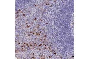Immunohistochemical staining of human tonsil with TLX2 polyclonal antibody  shows strong cytoplasmic positivity in subsets of non-germinal center cells. (TLX2 anticorps)