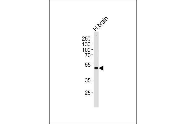 Kir2.2 anticorps  (C-Term)