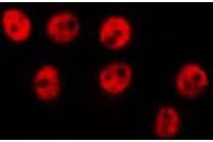 ABIN6275630 staining HepG2 by IF/ICC.