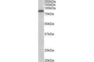 Western Blotting (WB) image for anti-Solute Carrier Family 6 (Neurotransmitter Transporter, Dopamine), Member 3 (SLC6A3) (Internal Region) antibody (ABIN2465033) (SLC6A3 anticorps  (Internal Region))