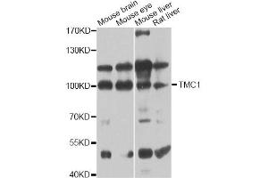 Western blot analysis of extracts of various cell lines, using TMC1 antibody (ABIN6293566) at 1:1000 dilution. (TMC1 anticorps)