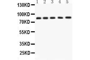 Western blot analysis of APLP1 using anti-APLP1 antibody .