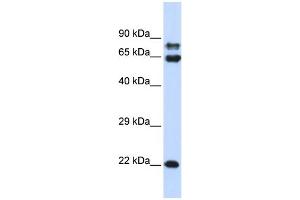 WB Suggested Anti-PPP2R1A Antibody Titration: 0. (PPP2R1A anticorps  (N-Term))