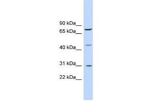 WB Suggested Anti-EGR3 Antibody Titration:  0.