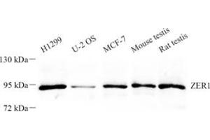 Western blot analysis of ZER1 (ABIN7076289) at dilution of 1: 500 (ZER1 anticorps)