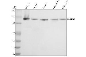 Western blot analysis of Dnmt3a using anti-Dnmt3a antibody (ABIN7604667).