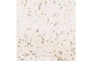 Immunohistochemistry of paraffin embedded rat brain using ACyclaseI (ABIN7072958) at dilution of 1:650 (300x lens) (ADCY1 anticorps)