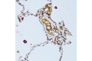 Immunohistochemistry of paraffin-embedded human lung using C1QC antibody (ABIN7266475) at dilution of 1:100 (40x lens).