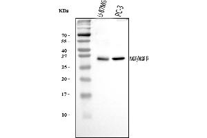 Western blot analysis of NGF using anti-NGF antibody (ABIN7599850).