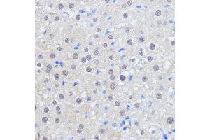 Immunohistochemistry of paraffin-embedded rat liver using RBM39 antibody (ABIN7270085) at dilution of 1:100 (40x lens).
